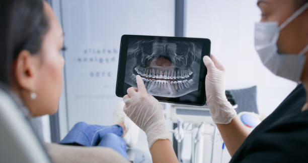 Licensed Tooth Extraction service in Victorville, CA - Smile Center Dentistry